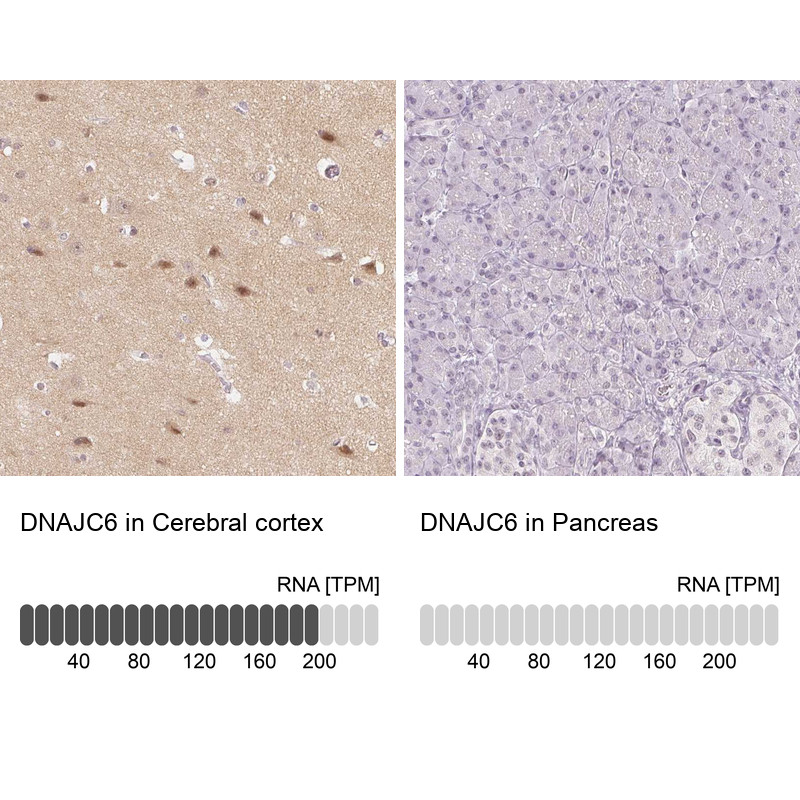 Immunohistochemistry analysis in human cerebral cortex and pancreas tissues using Anti-DNAJC6 antibody. Corresponding DNAJC6 RNA-seq data are presented for the same tissues.