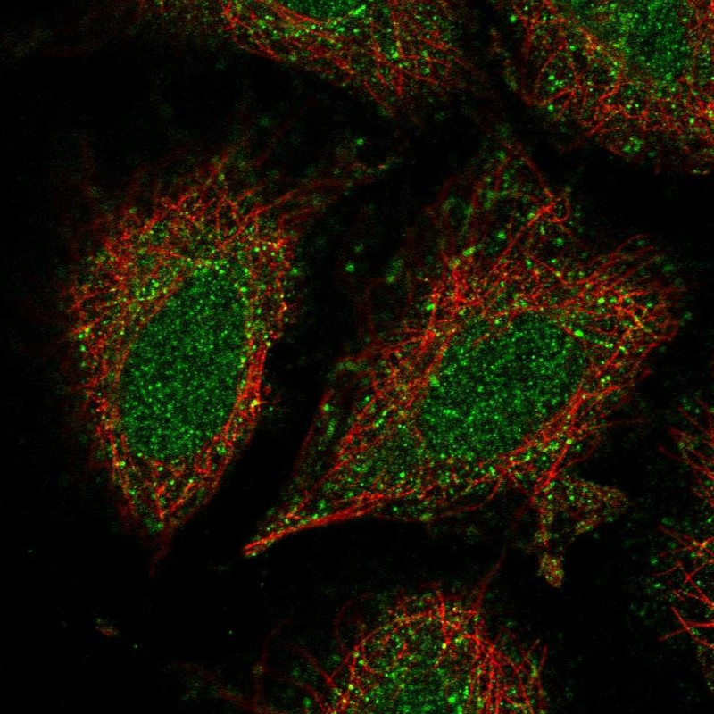 Immunofluorescent staining of human cell line SiHa shows localization to nucleus & vesicles.