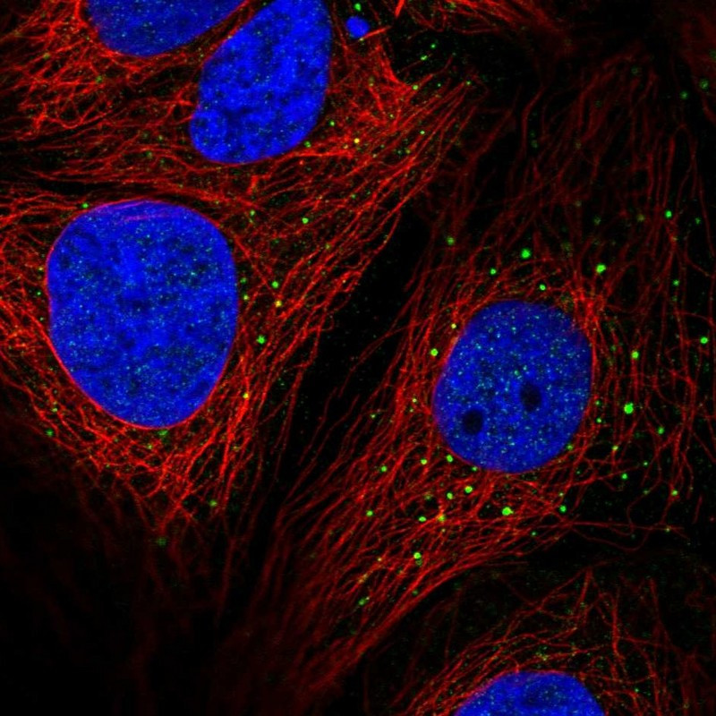 Immunofluorescent staining of human cell line CACO-2 shows localization to vesicles.