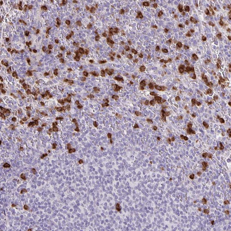 Immunohistochemical staining of human spleen shows strong cytoplasmic positivity in cells in red pulp.