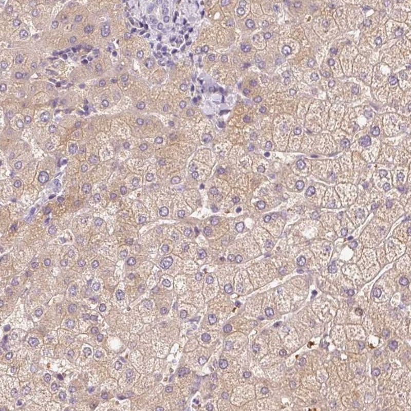 Immunohistochemical staining of human liver shows moderate cytoplasmic positivity in hepatocytes.