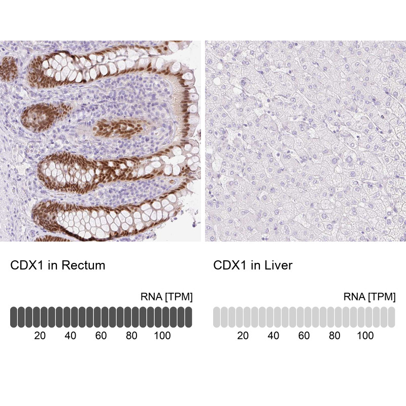 Immunohistochemistry analysis in human rectum and liver tissues using Anti-CDX1 antibody. Corresponding CDX1 RNA-seq data are presented for the same tissues.