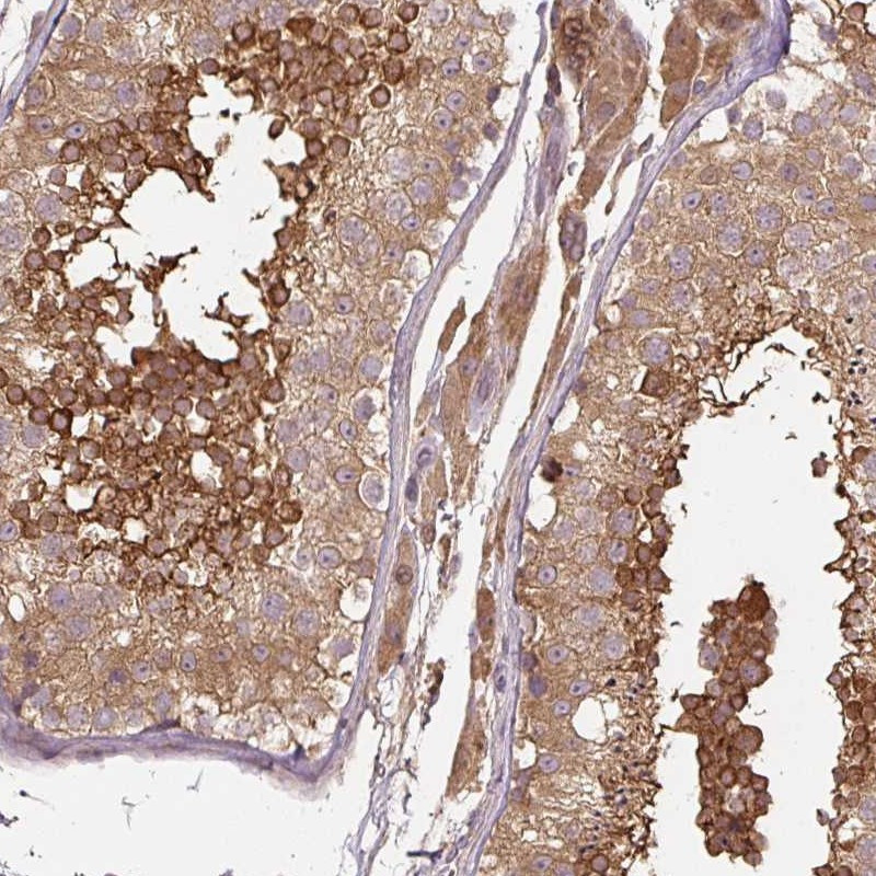 Immunohistochemical staining of human testis shows strong cytoplasmic positivity in cells in seminiferus ducts.