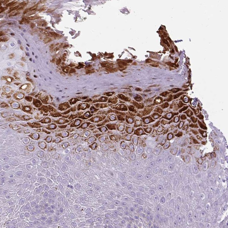 Immunohistochemical staining of human skin shows cytoplasmic positivity in epidermal cells.