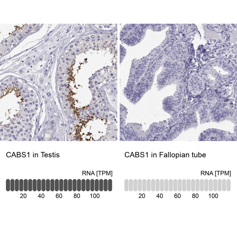 Immunohistochemistry analysis in human testis and fallopian tube tissues using Anti-CABS1 antibody. Corresponding CABS1 RNA-seq data are presented for the same tissues.