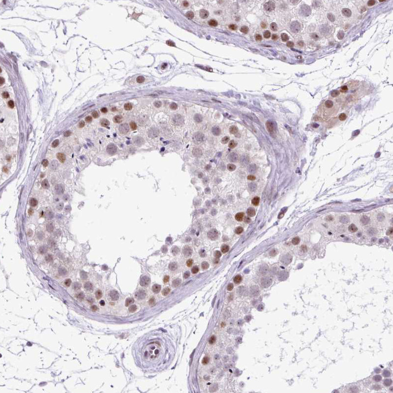 Immunohistochemical staining of human testis shows moderate nuclear positivity in cells in seminiferous ducts.