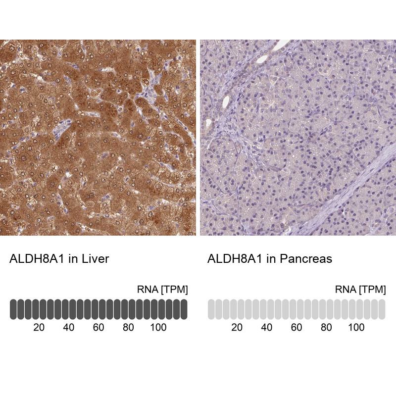 Immunohistochemistry analysis in human liver and pancreas tissues using Anti-ALDH8A1 antibody. Corresponding ALDH8A1 RNA-seq data are presented for the same tissues.