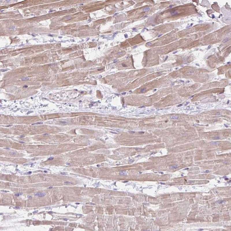 Immunohistochemical staining of human heart muscle shows moderate cytoplasmic positivity in myocytes.