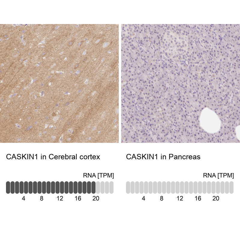 Immunohistochemistry analysis in human cerebral cortex and pancreas tissues using Anti-CASKIN1 antibody. Corresponding CASKIN1 RNA-seq data are presented for the same tissues.