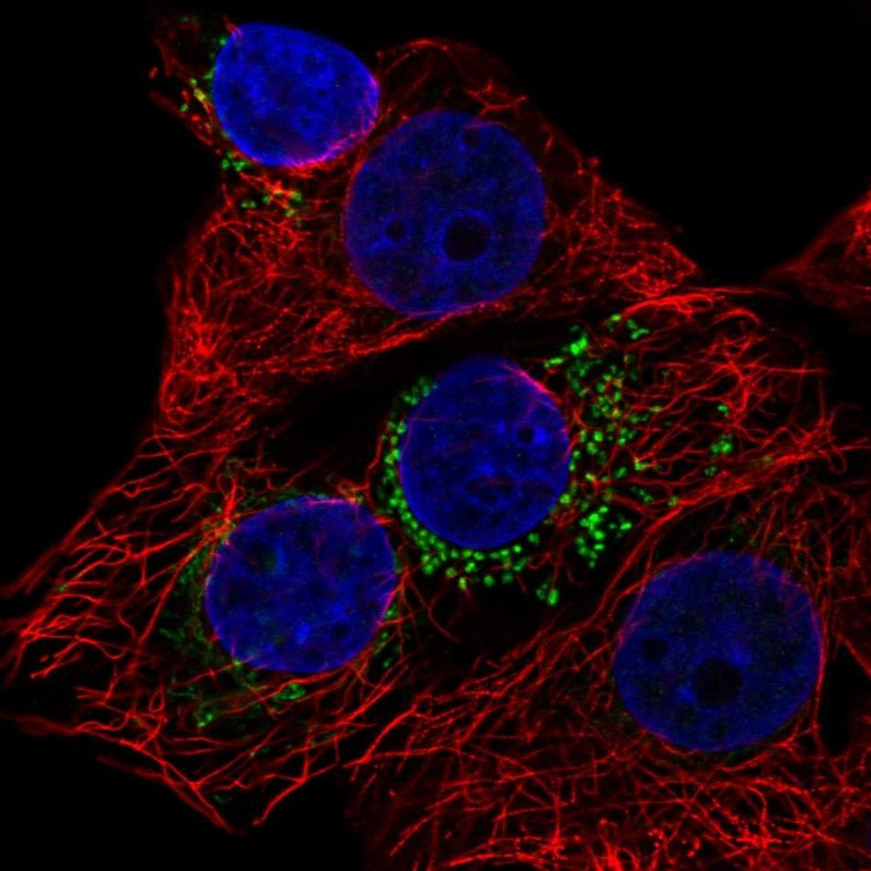 Immunofluorescent staining of human cell line MCF7 shows localization to vesicles.