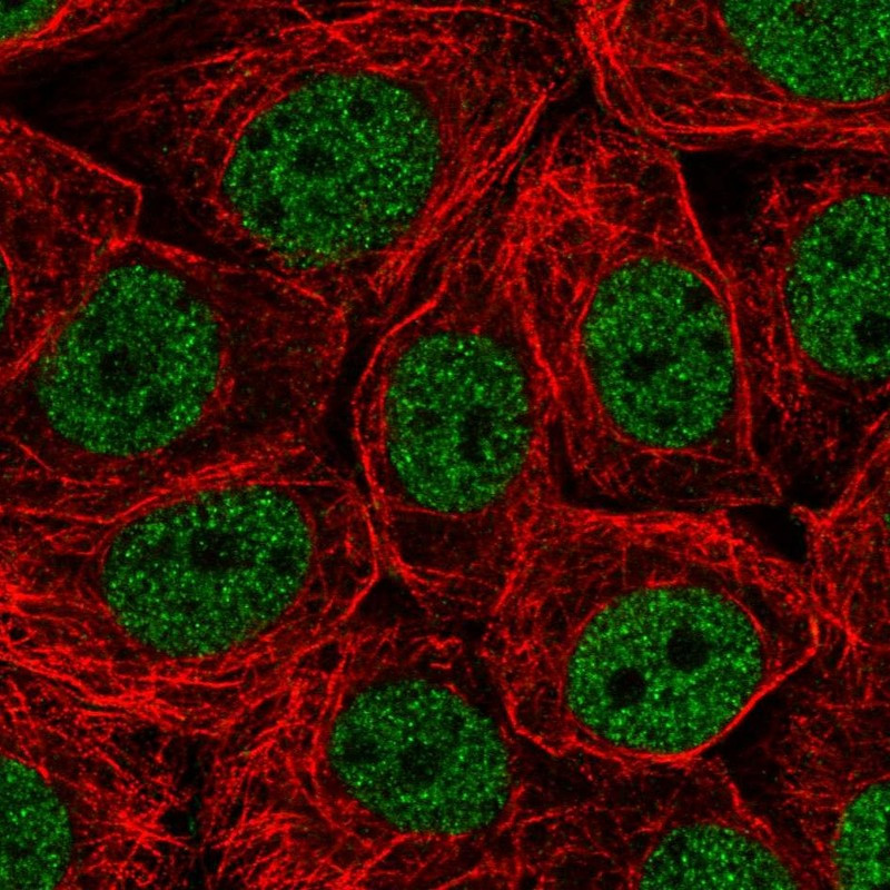 Immunofluorescent staining of human cell line MCF7 shows localization to nucleoplasm.
