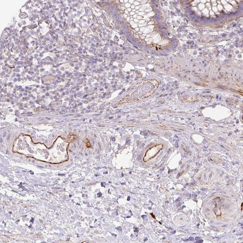 Immunohistochemical staining of human colon shows strong positivity in endothelial cells.