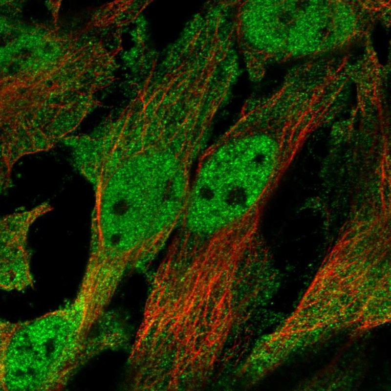 Immunofluorescent staining of human cell line HeLa shows localization to nucleoplasm & plasma membrane.