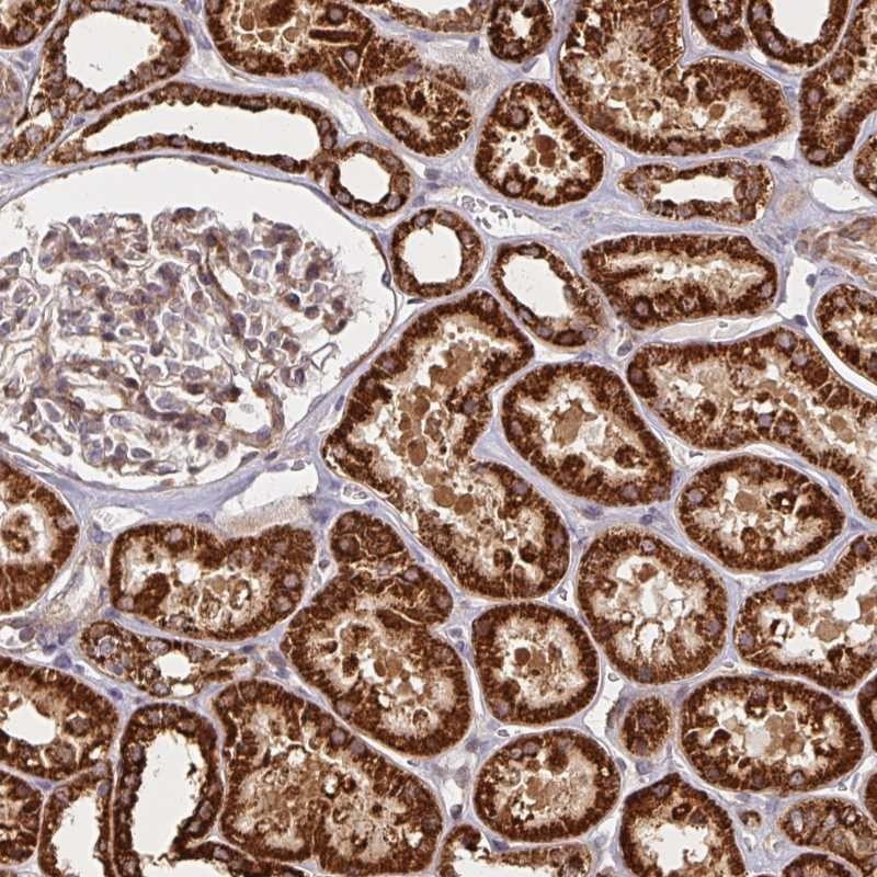 Immunohistochemical staining of human kidney shows strong cytoplasmic positivity in renal tubules.