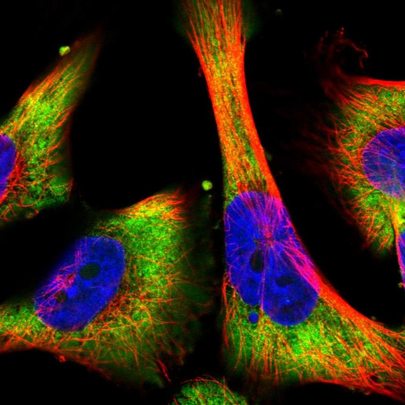 Immunofluorescent staining of human cell line U-251 MG shows localization to cytosol.