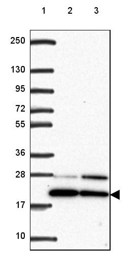 Lane 1: Marker [kDa] 250, 130, 95, 72, 55, 36, 28, 17, 10<br/>Lane 2: Human cell line RT-4<br/>Lane 3: Human cell line U-251 MG