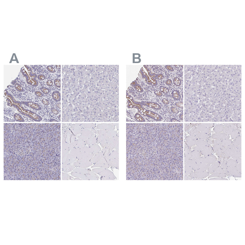 Immunohistochemical staining of human gastrointestinal, liver, pancreas and skeletal muscle using Anti-CHMP5 antibody HPA056437 (A) shows similar protein distribution across tissues to independent antibody HPA042883 (B).