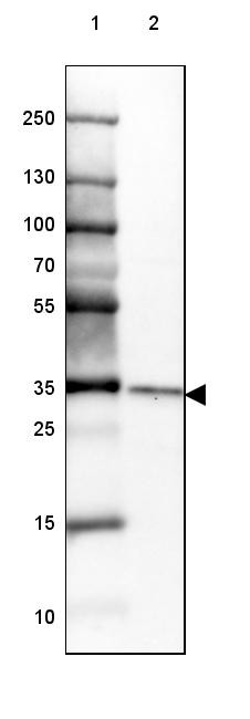 Lane 1: Marker [kDa] 250, 130, 100, 70, 55, 35, 25, 15, 10<br/>Lane 2: Human Kidney tissue