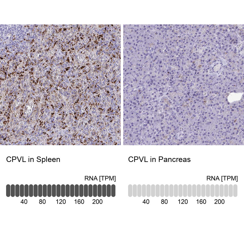 Immunohistochemistry analysis in human spleen and pancreas tissues using Anti-CPVL antibody. Corresponding CPVL RNA-seq data are presented for the same tissues.