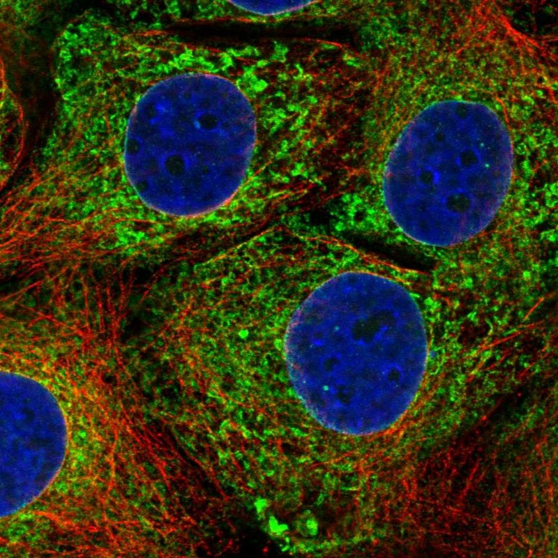 Immunofluorescent staining of human cell line CACO-2 shows localization to endoplasmic reticulum.
