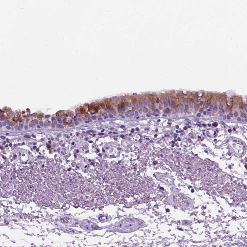 Immunohistochemical staining of human bronchus shows strong positivity in respiratory epithelial cells.