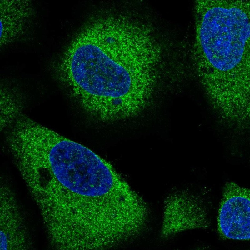 Immunofluorescent staining of human cell line A549 shows localization to cytosol & endoplasmic reticulum.