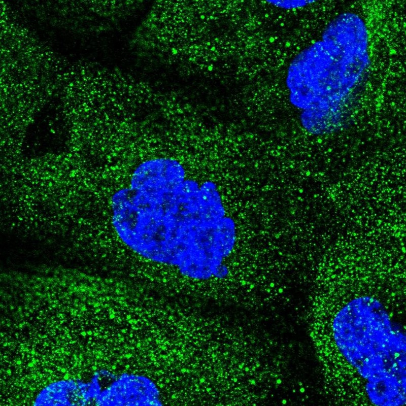 Immunofluorescent staining of human cell line A-431 shows localization to cytosol.