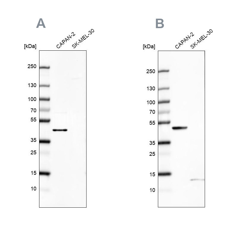 Western blot analysis using Anti-COQ2 antibody HPA056599 (A) shows similar pattern to independent antibody HPA068727 (B).