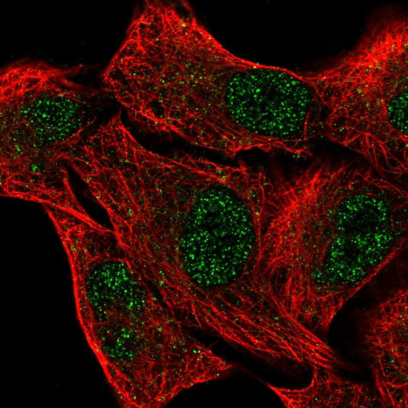 Immunofluorescent staining of human cell line A549 shows localization to nucleoplasm.