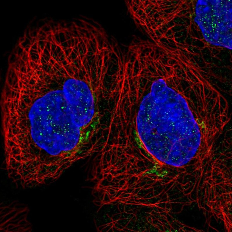 Immunofluorescent staining of human cell line A-431 shows localization to the Golgi apparatus.