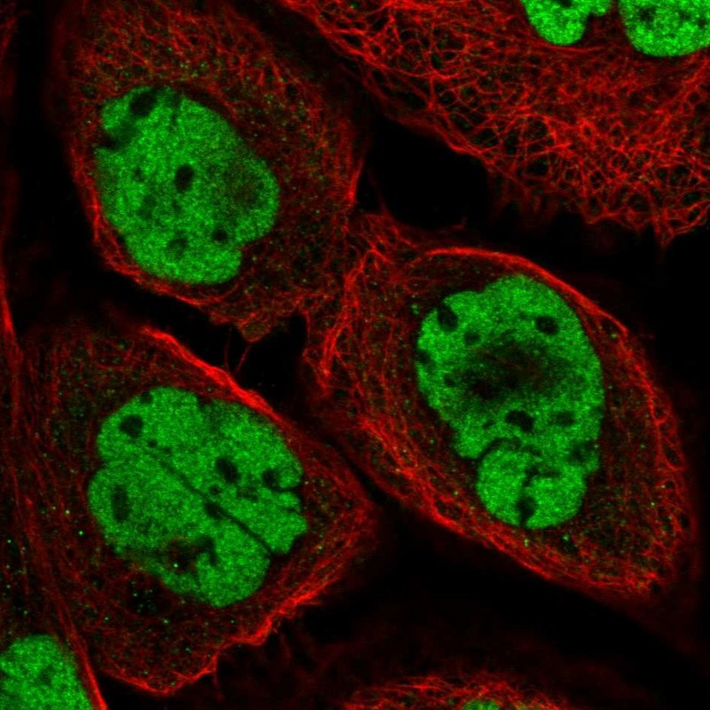 Immunofluorescent staining of human cell line A-431 shows localization to nucleoplasm.