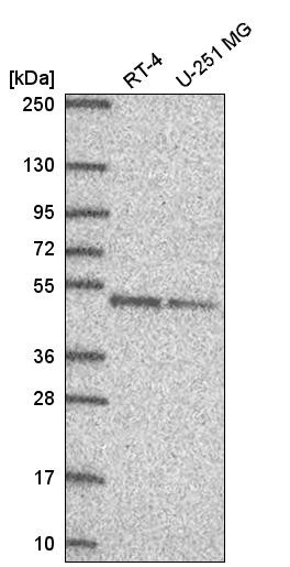 Western blot analysis in human cell line RT-4 and human cell line U-251 MG.
