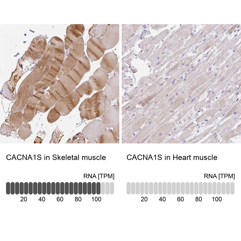Immunohistochemistry analysis in human skeletal muscle and heart muscle tissues using Anti-CACNA1S antibody. Corresponding CACNA1S RNA-seq data are presented for the same tissues.