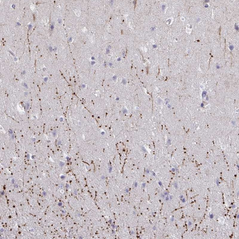 Immunohistochemical staining of human cerebral cortex shows strong cytoplasmic positivity in neuropil.