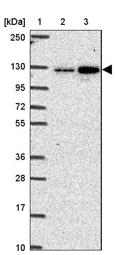 Lane 1: Marker [kDa] 250, 130, 95, 72, 55, 36, 28, 17, 10<br/>Lane 2: Human cell line RT-4<br/>Lane 3: Human cell line U-251 MG