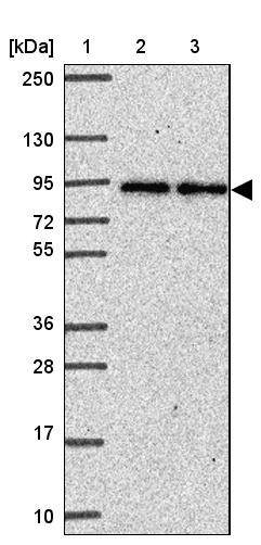 Lane 1: Marker [kDa] 250, 130, 95, 72, 55, 36, 28, 17, 10<br/>Lane 2: Human cell line RT-4<br/>Lane 3: Human cell line U-251MG sp