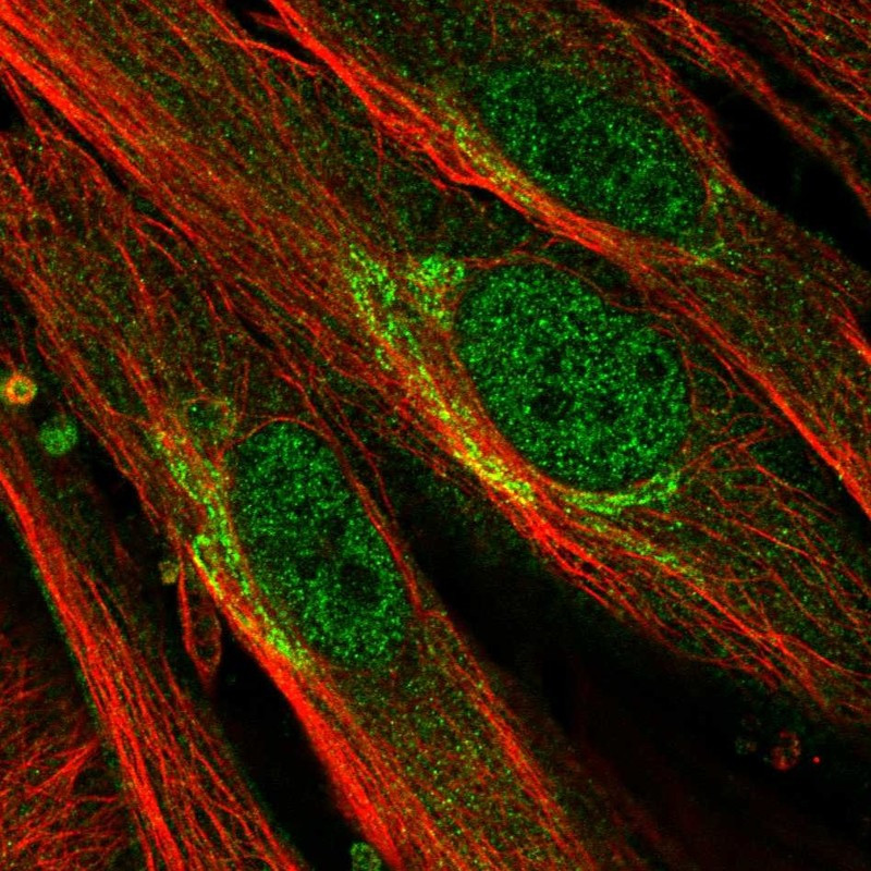 Immunofluorescent staining of human cell line BJ shows localization to nucleoplasm & the Golgi apparatus.
