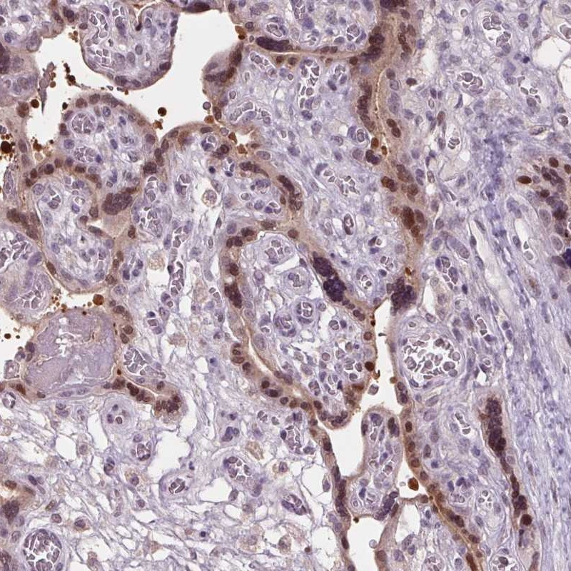 Immunohistochemical staining of human placenta shows moderate nuclear positivity in trophoblastic cells.