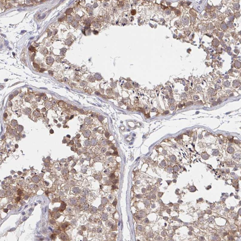 Immunohistochemical staining of human testis shows moderate cytoplasmic positivity in cells in seminiferus ducts.