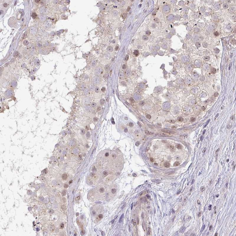 Immunohistochemical staining of human testis shows weak nuclear and cytoplasmic positivity in cells in seminiferus ducts.