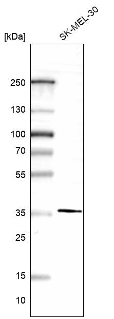 Western blot analysis in human cell line RT-4 and human cell line U-251 MG.