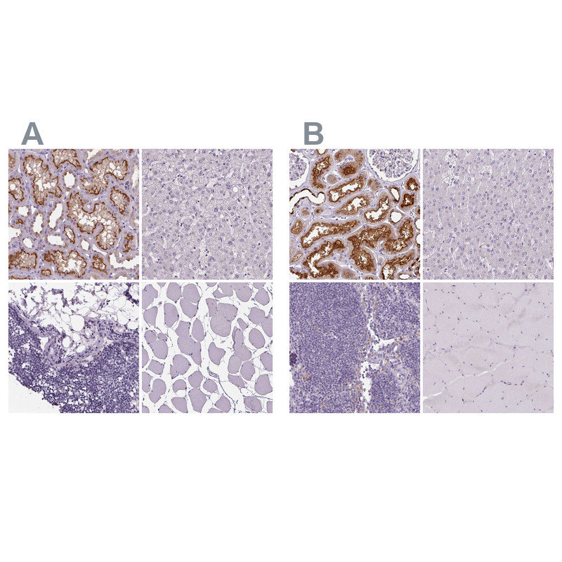 Immunohistochemical staining of human kidney, liver, lymph node and skeletal muscle using Anti-ATP6V1D antibody HPA057316 (A) shows similar protein distribution across tissues to independent antibody HPA031515 (B).