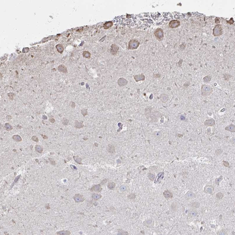 Immunohistochemical staining of human hippocampus shows moderate cytoplasmic positivity in neuronal cells.