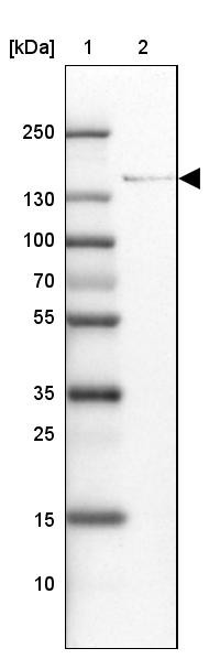 Lane 1: Marker [kDa] 250, 130, 100, 70, 55, 35, 25, 15, 10<br/>Lane 2: Human cell line U-87 MG