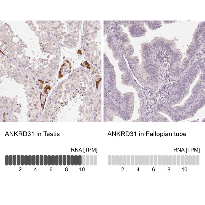 Immunohistochemistry analysis in human testis and fallopian tube tissues using Anti-ANKRD31 antibody. Corresponding ANKRD31 RNA-seq data are presented for the same tissues.