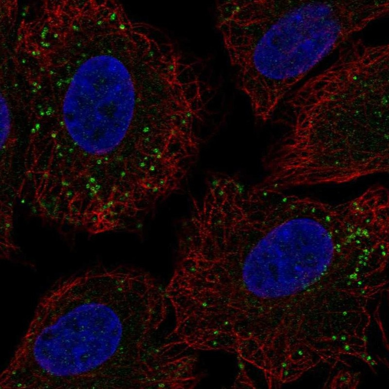 Immunofluorescent staining of human cell line A549 shows localization to vesicles.
