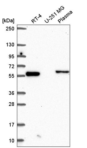 Western blot analysis in human cell line RT-4, human cell line U-251 MG and human plasma.