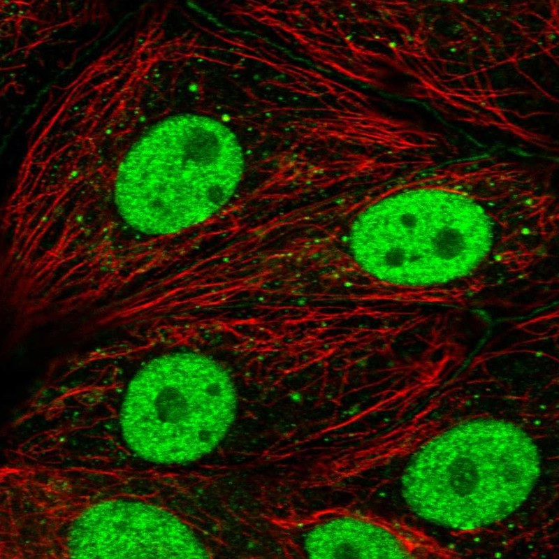 Immunofluorescent staining of human cell line MCF7 shows localization to nucleoplasm, cell junctions & cytoplasmic bodies.