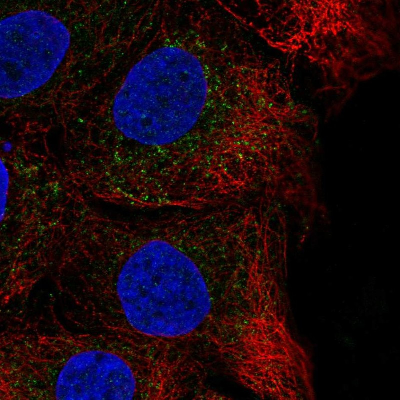 Immunofluorescent staining of human cell line HaCaT shows localization to vesicles.