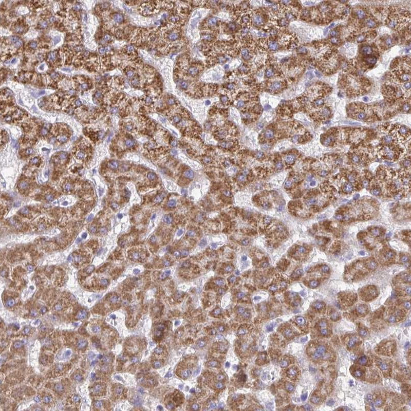 Immunohistochemical staining of human liver shows strong cytoplasmic positivity in hepatocytes.